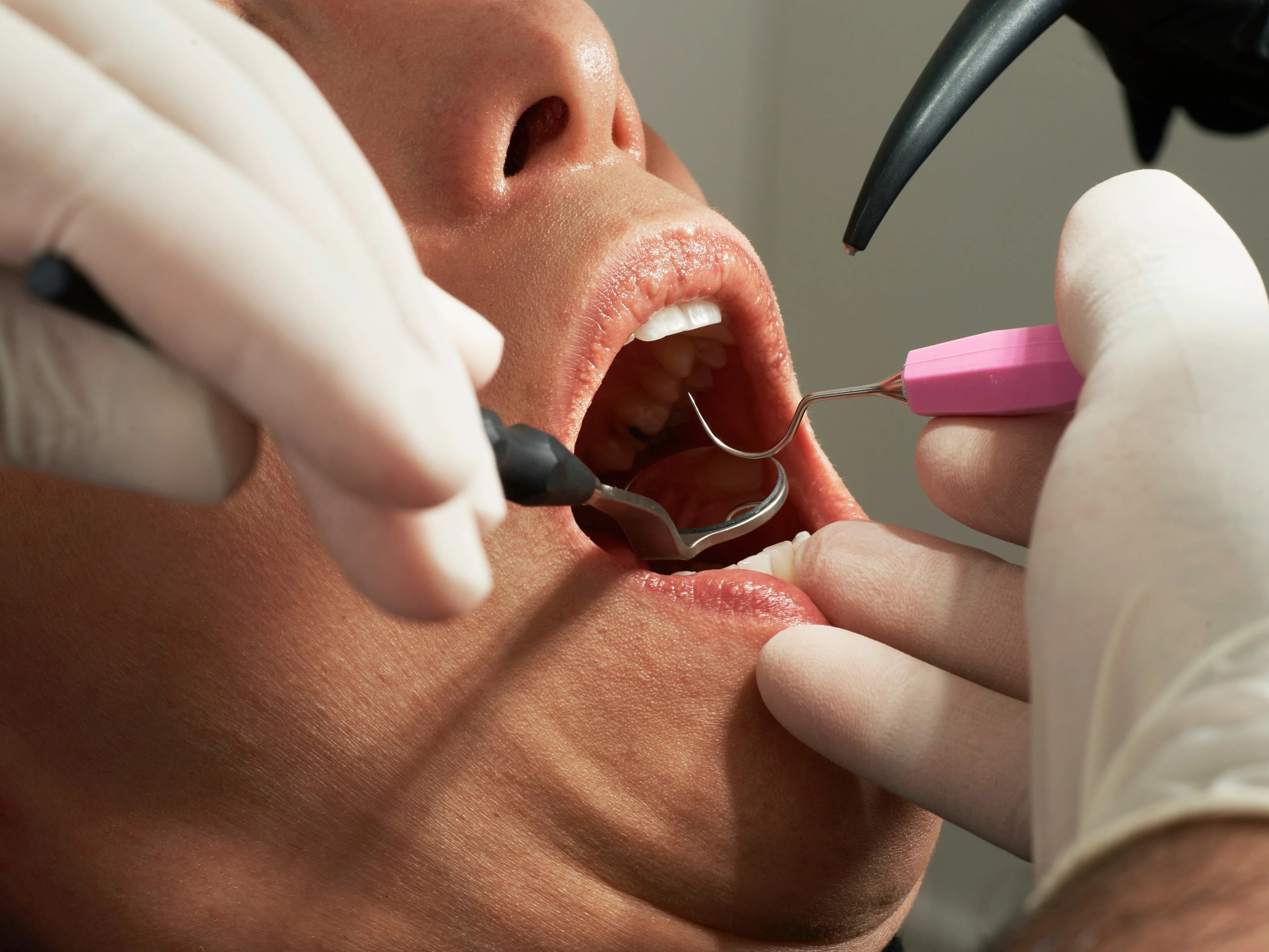 close up of a dental exam
