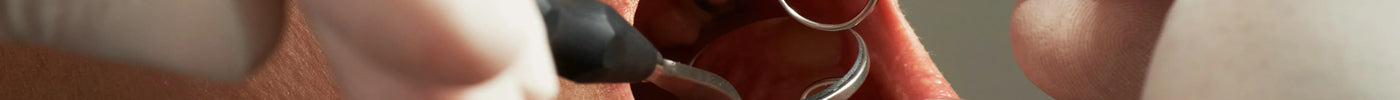 close up of a dental exam