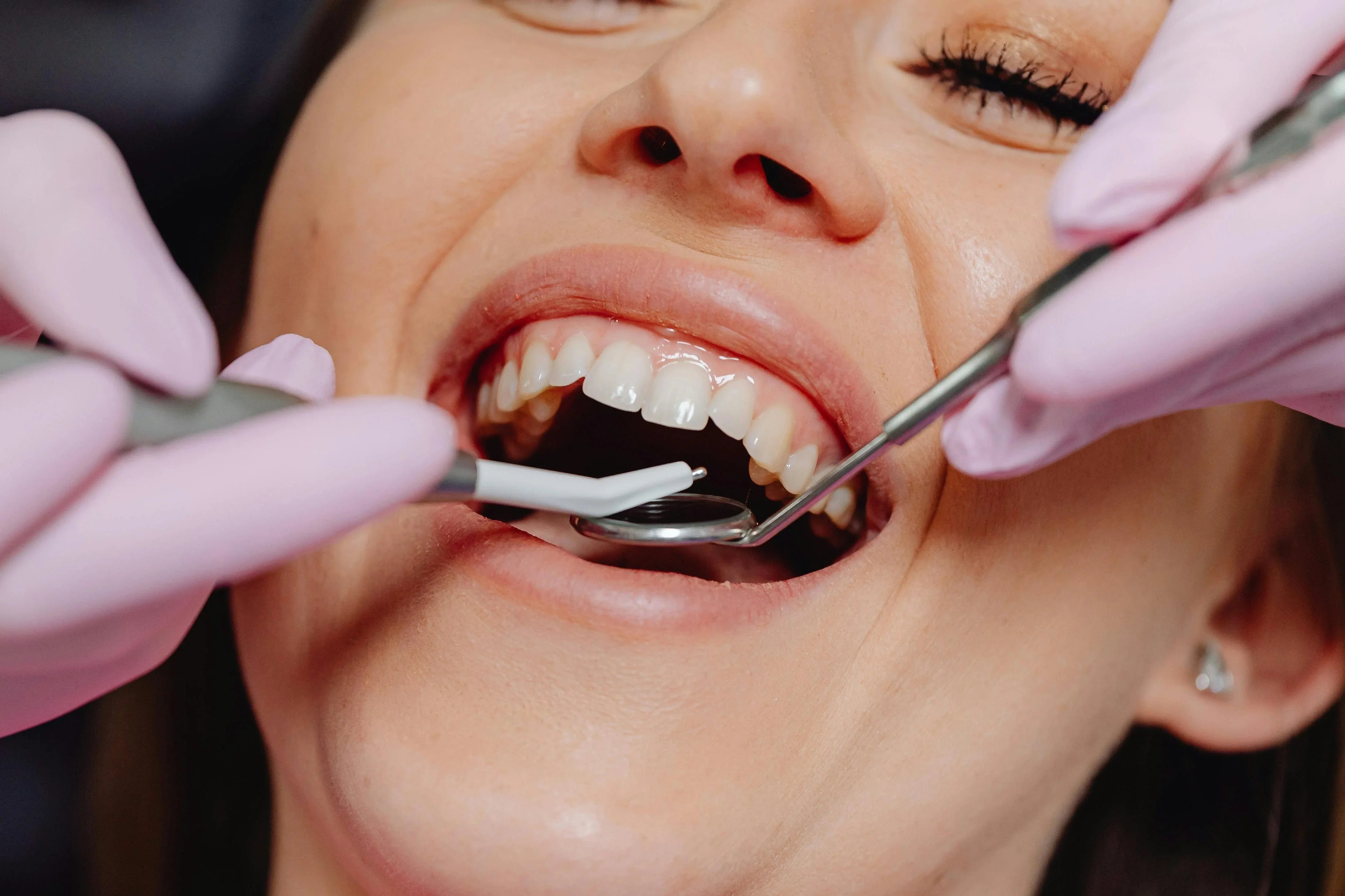 close up of woman having a teeth cleaning by a dentist